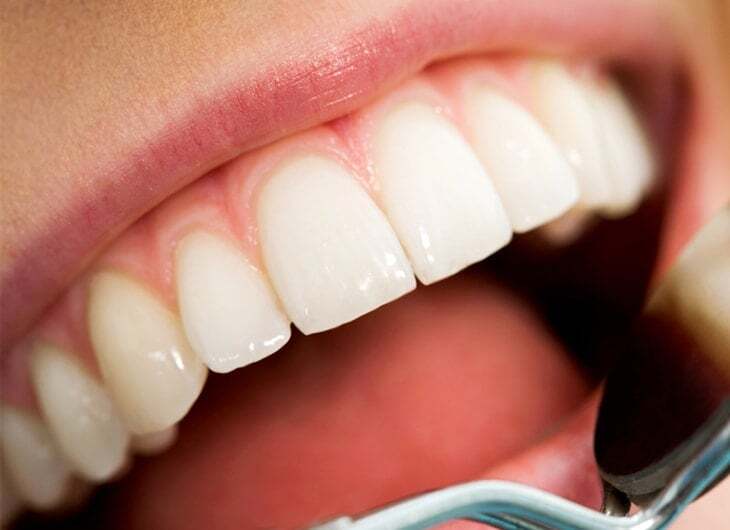 Стоматолог рассказал, из чего состоят зубы и как их лучше всего защитить от разрушения